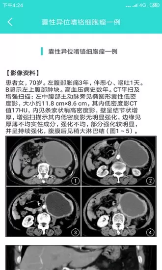 影像图鉴安卓下载